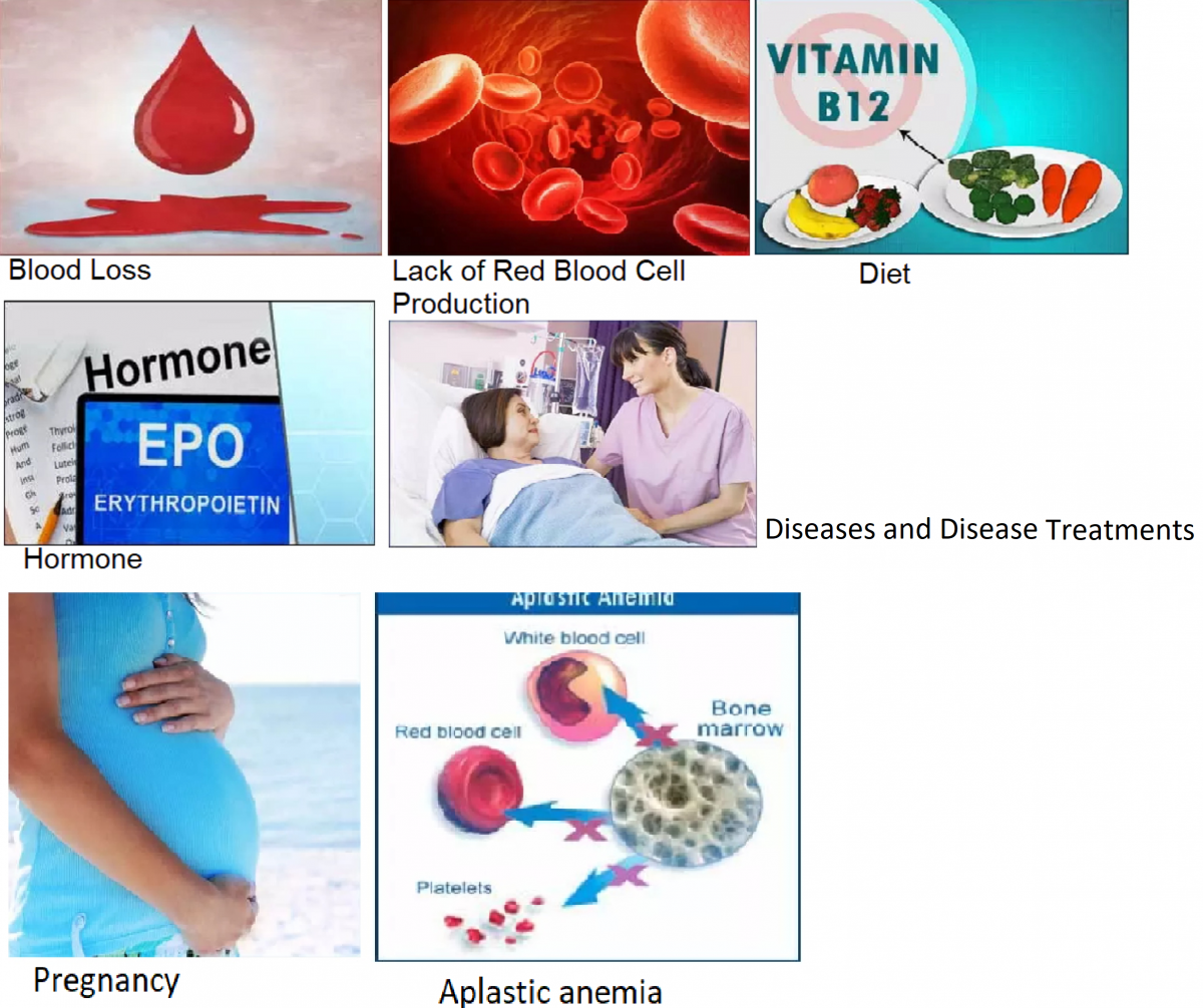 Causes Of Anemia 3768